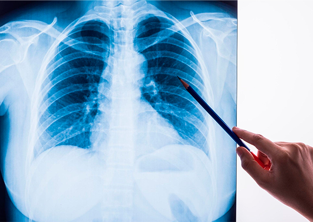 Профессиональная переподготовка по пульмонологии